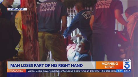 Man loses part of hand, house catches fire in July 4 fireworks mishaps in Los Angeles
